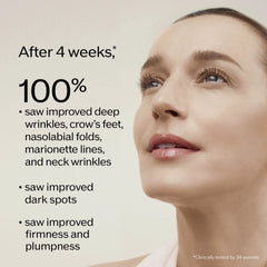 Vital Perfection Intensive WrinkleSpot Treatment A+