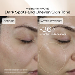 Benefiance Dark Spot and Wrinkle Smoothing Serum